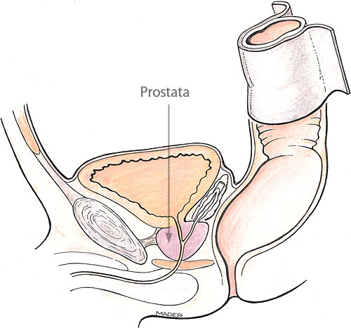 Die Prostata wird dabei mit einem oder mehreren Fingern massiert und gereiz...